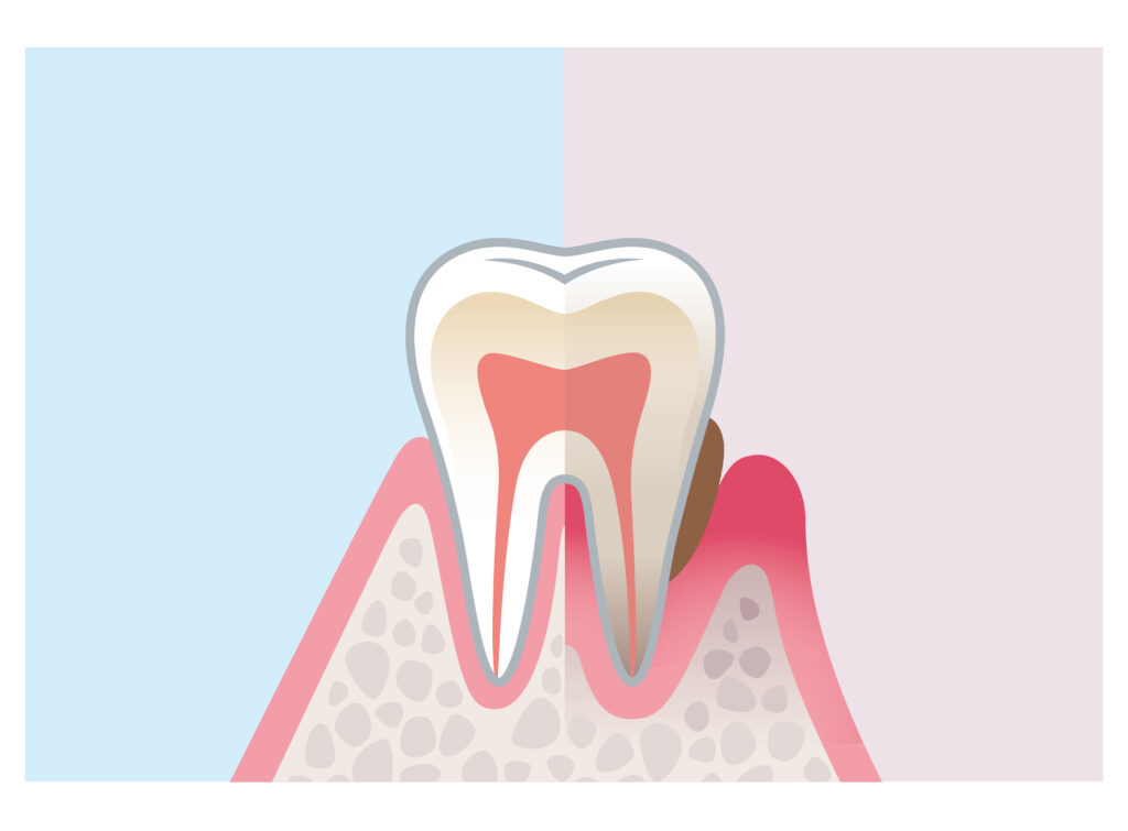 ランフォード＆アッシュ　歯周病の基礎と臨床 ランフォード＆アッシュ 歯周病の基礎と臨床／医歯薬出版株式会社